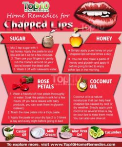 Home Remedies for Chapped-lips