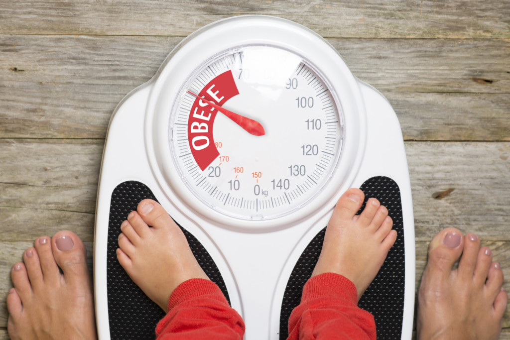 New AAP Guidelines for Treating Childhood Obesity