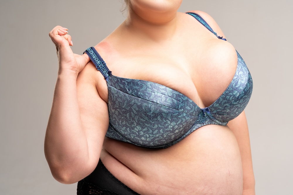 poorly fitting bra curvy woman