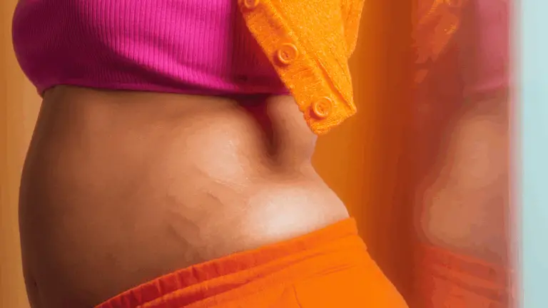 stretch marks are moment